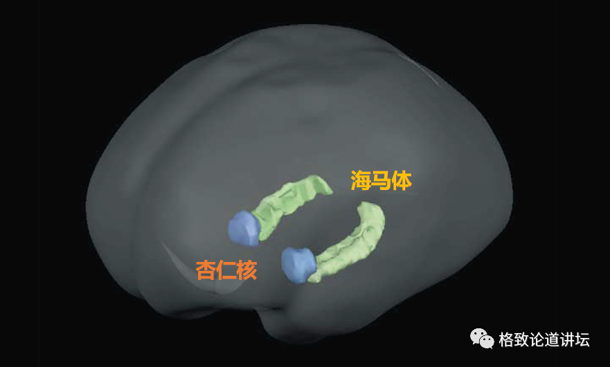 article_20240816_12.png