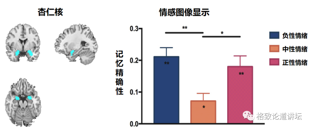 article_20240816_24.png