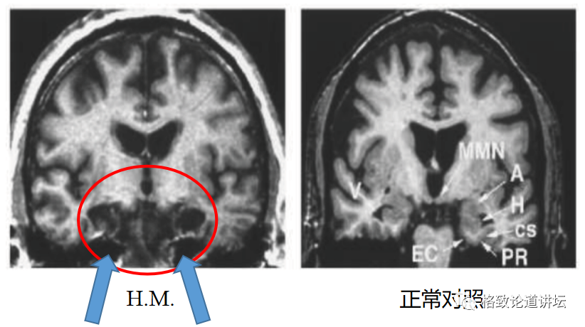 article_20240816_5.png